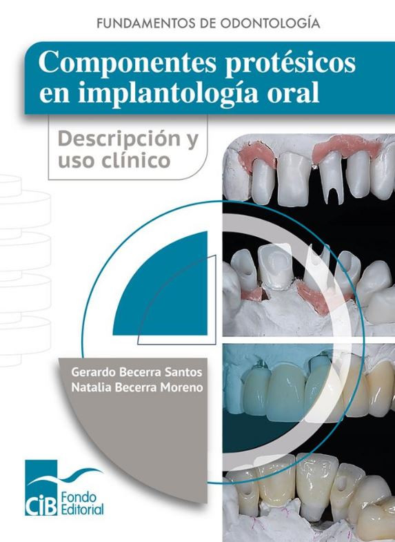 Portada: Componentes protésicos en implantología oral