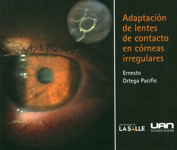 Adaptación de lentes de contacto en córneas irregulares